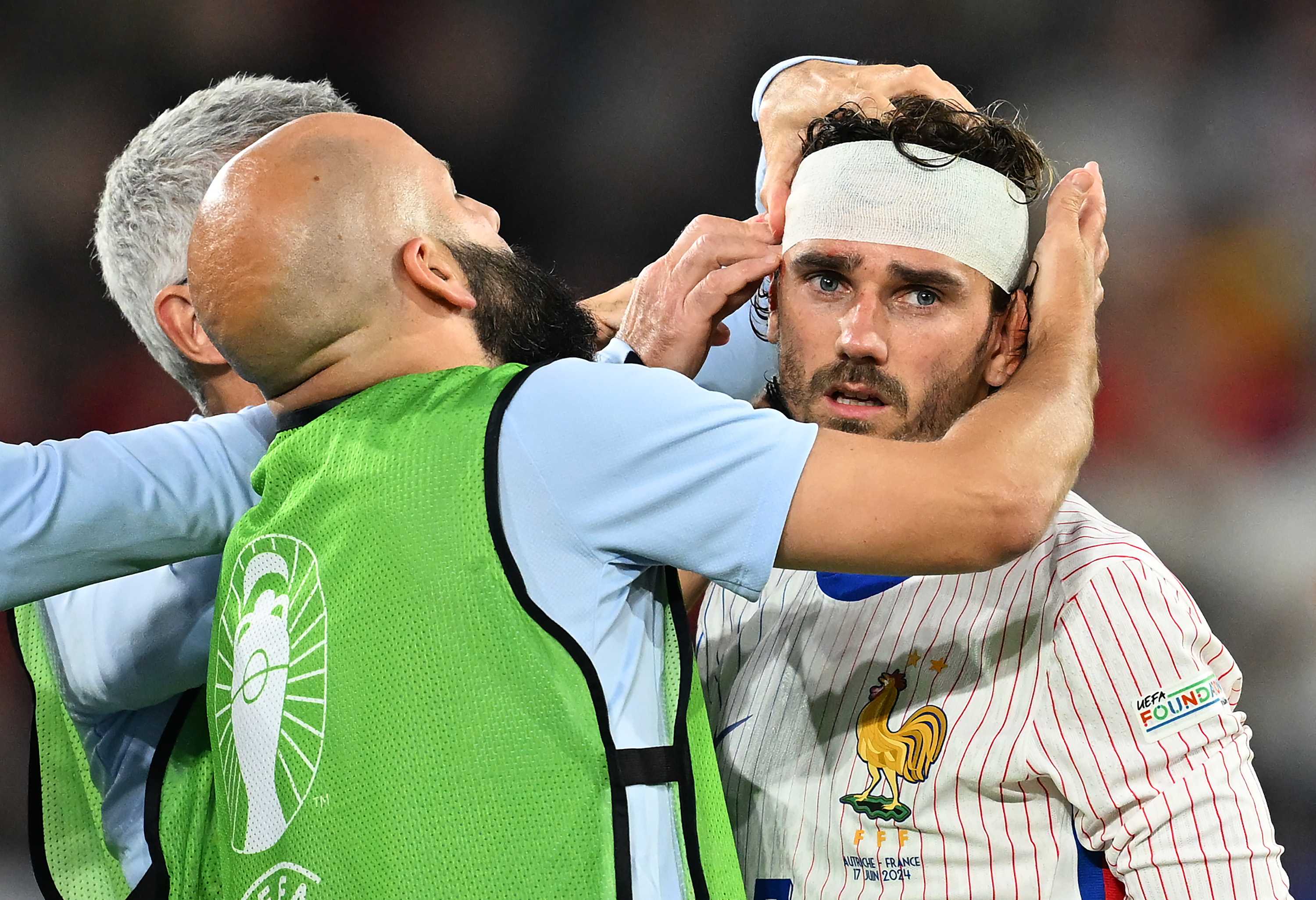 France star Antoine Griezmann left bloody after heavy collision with  billboard at EURO 2024